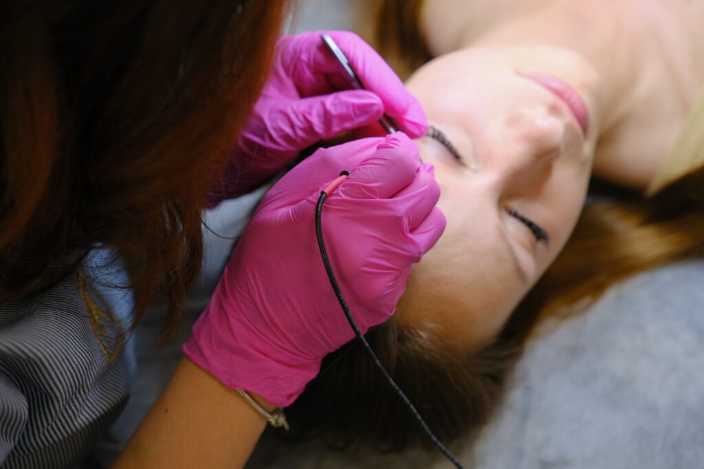 Young woman dermatologist doing hair removal treatment on patient's face with electrolysis